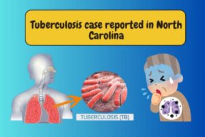 Tuberculosis case reported in North Carolina